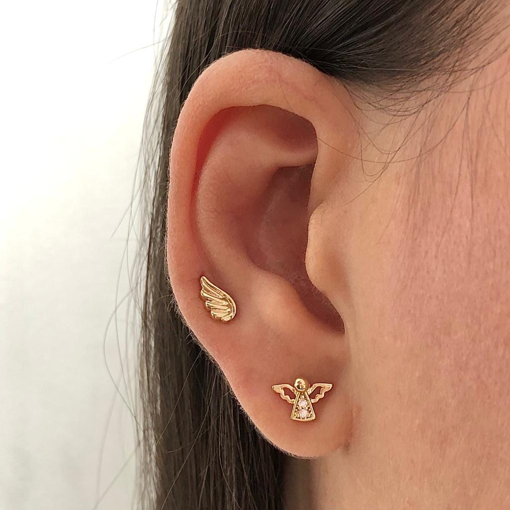 Arete Ala