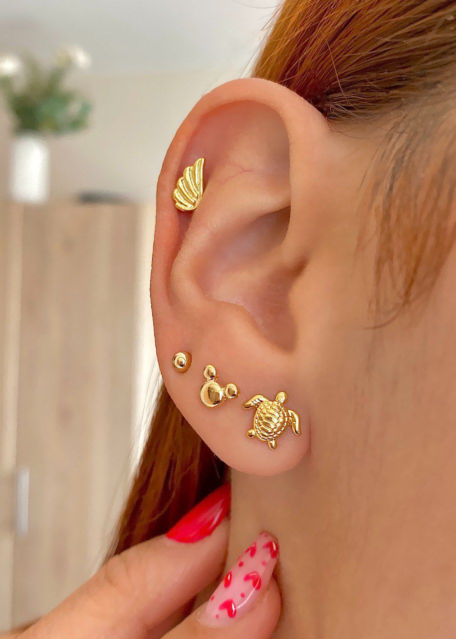 Arete Turtle
