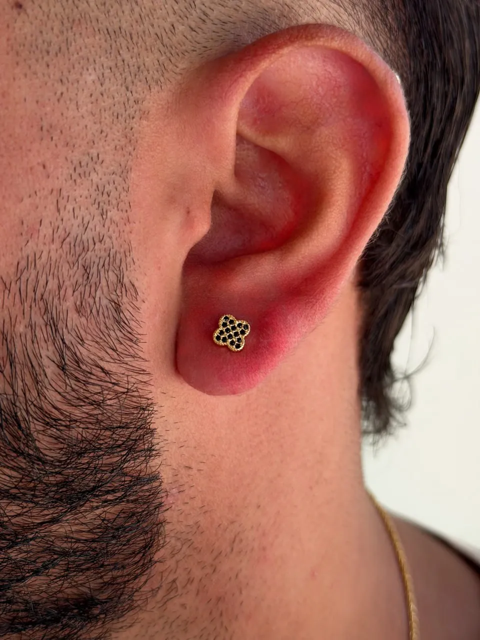 Arete Luck Clover 7mm